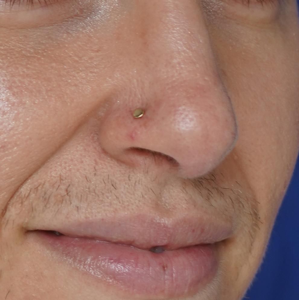 Close up view of a model's nose wearing a yellow gold Circle Nose Stud